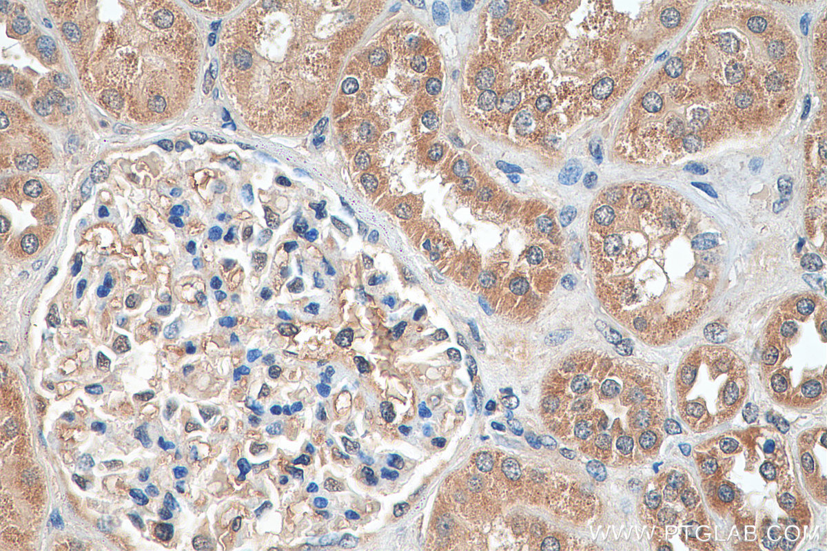 Immunohistochemistry (IHC) staining of human kidney tissue using RB1CC1 Polyclonal antibody (10069-1-AP)