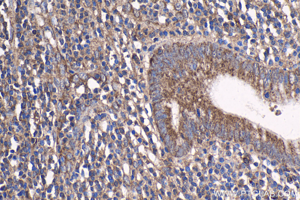 Immunohistochemistry (IHC) staining of human appendicitis tissue using RB1CC1 Polyclonal antibody (10069-1-AP)