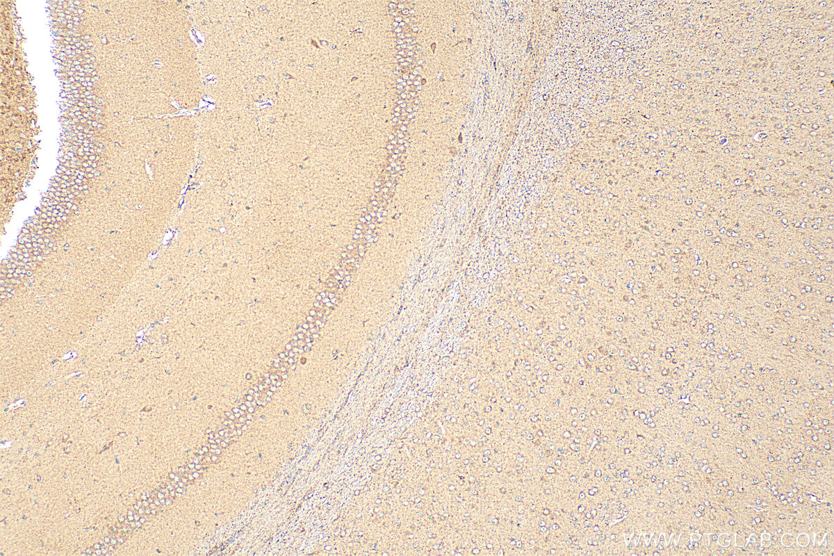 Immunohistochemistry (IHC) staining of mouse brain tissue using RB1CC1 Polyclonal antibody (17250-1-AP)