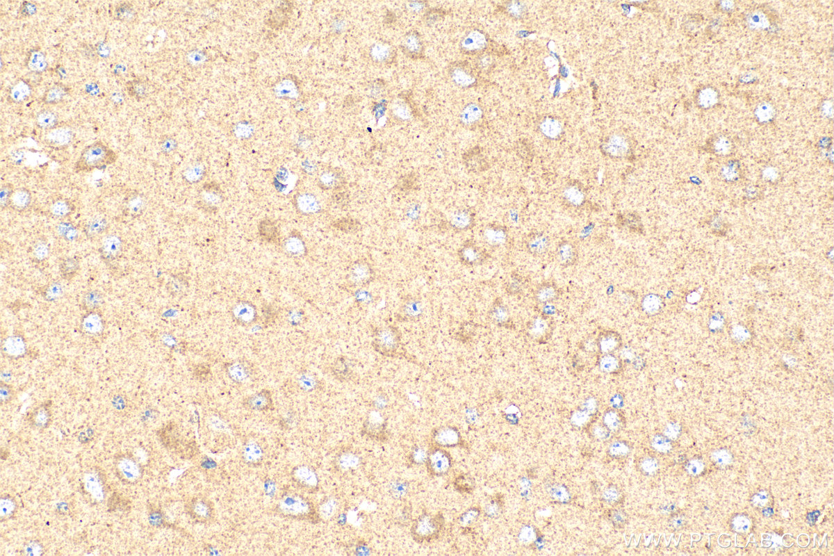 Immunohistochemistry (IHC) staining of mouse brain tissue using RB1CC1 Polyclonal antibody (17250-1-AP)