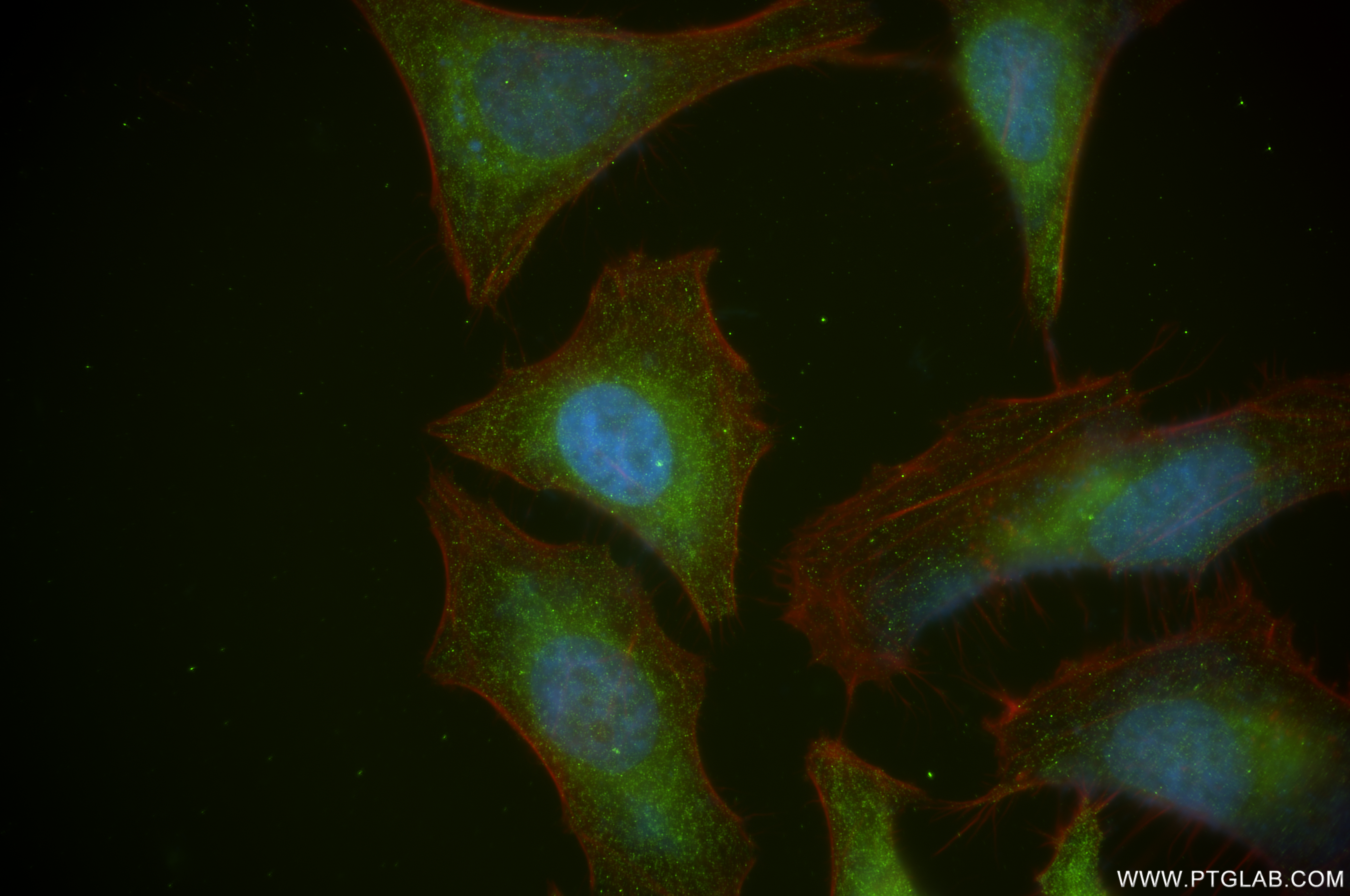 Immunofluorescence (IF) / fluorescent staining of HeLa cells using RB1CC1 Recombinant antibody (84757-3-RR)