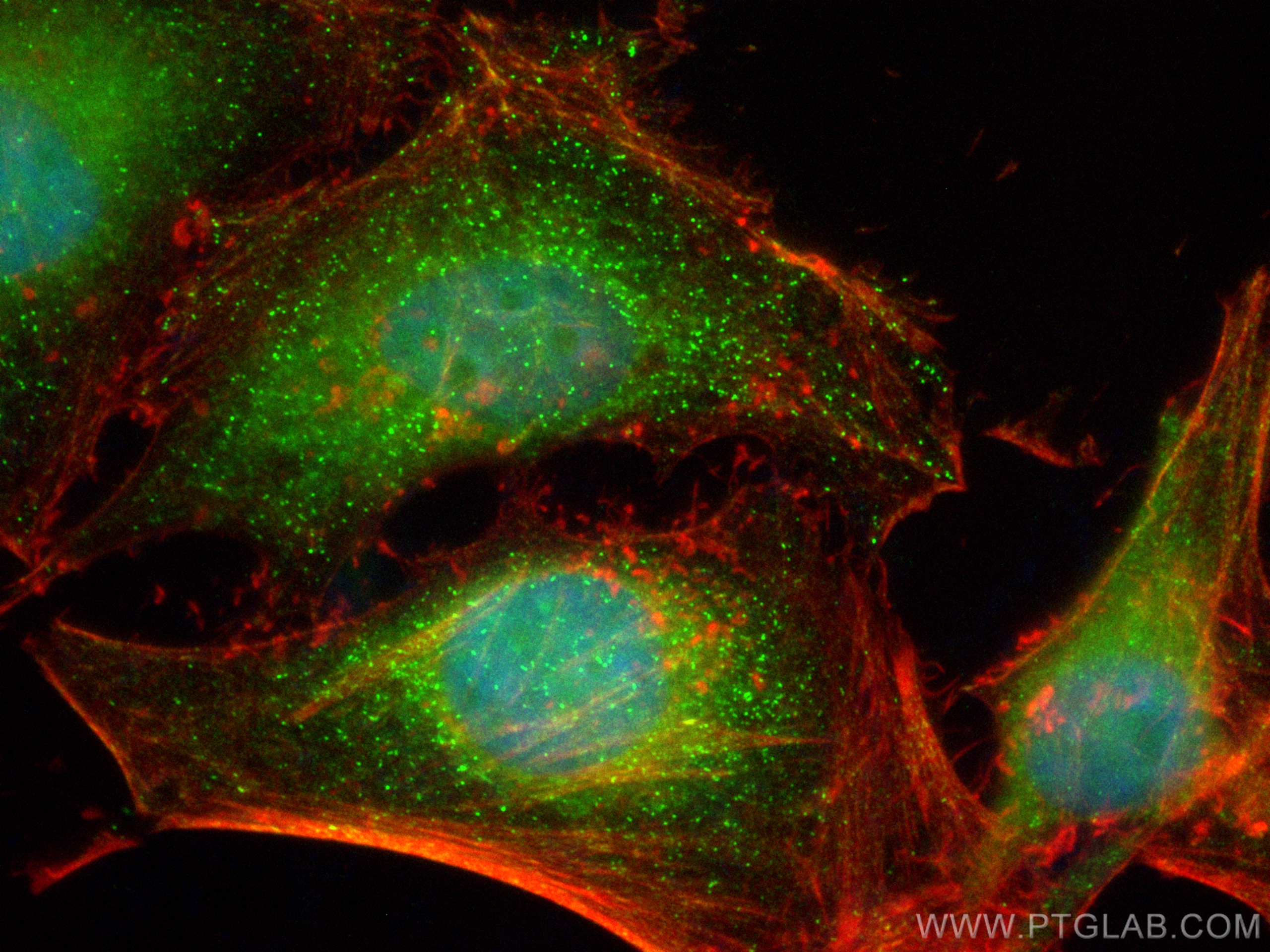 Immunofluorescence (IF) / fluorescent staining of HeLa cells using CoraLite® Plus 488-conjugated RB1CC1 Polyclonal an (CL488-10069)
