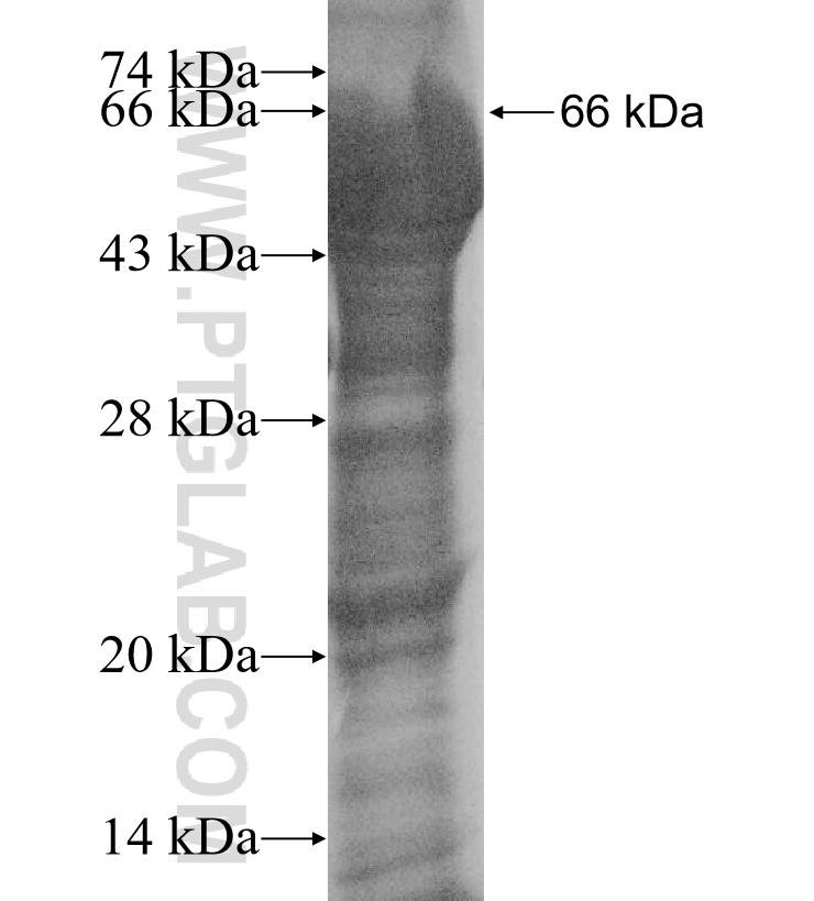 RB1CC1 fusion protein Ag15739 SDS-PAGE