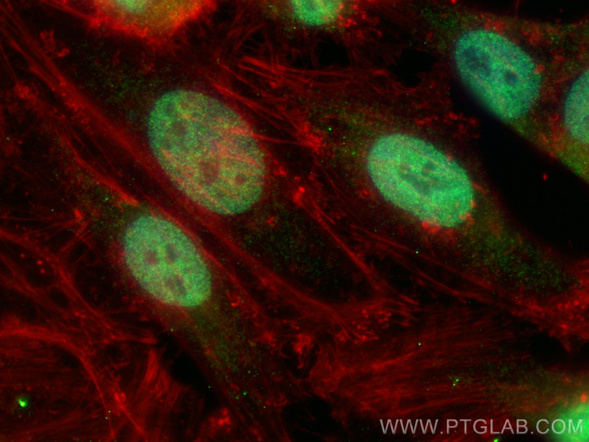 Immunofluorescence (IF) / fluorescent staining of HeLa cells using RBAP48 Polyclonal antibody (14557-1-AP)