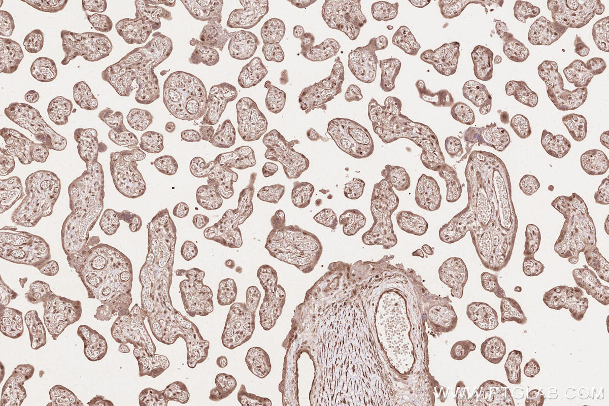 Immunohistochemistry (IHC) staining of human placenta tissue using RBBP6 Polyclonal antibody (11882-1-AP)