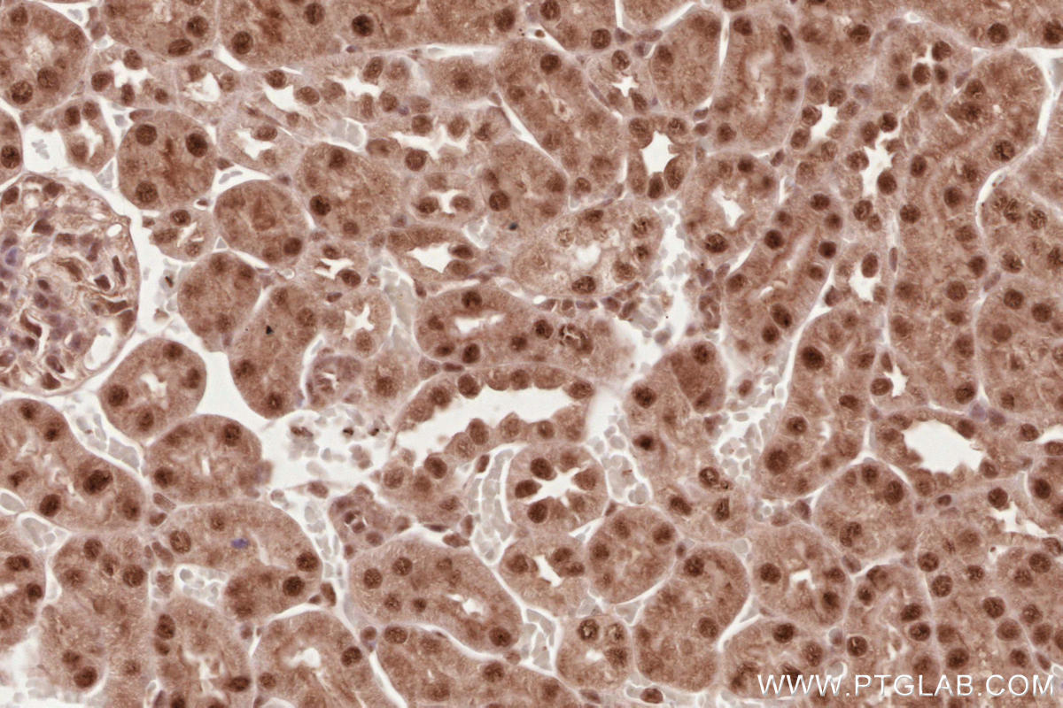 Immunohistochemistry (IHC) staining of mouse kidney tissue using RBBP6 Polyclonal antibody (11882-1-AP)