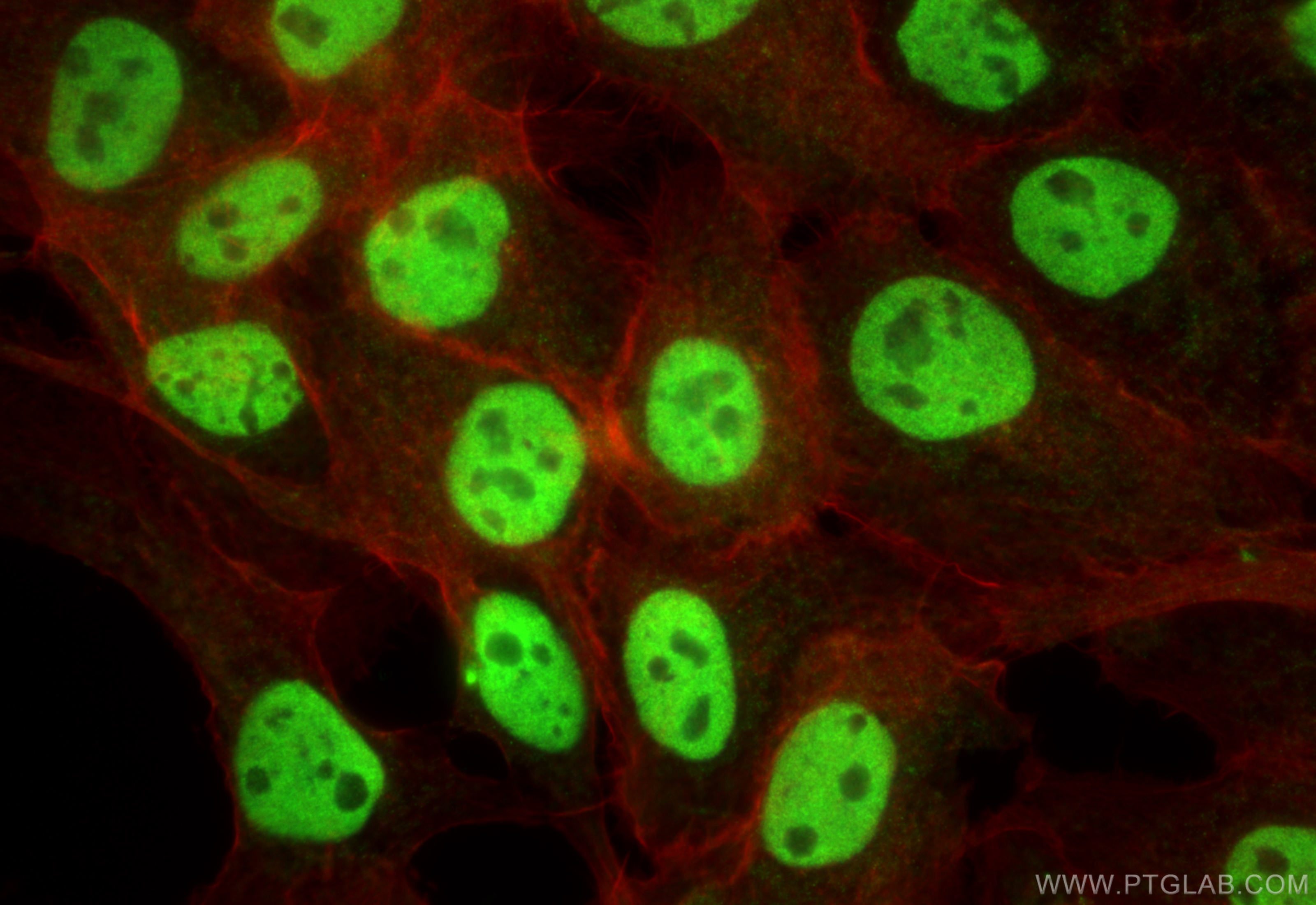 Immunofluorescence (IF) / fluorescent staining of A431 cells using RbAp46 Polyclonal antibody (20365-1-AP)