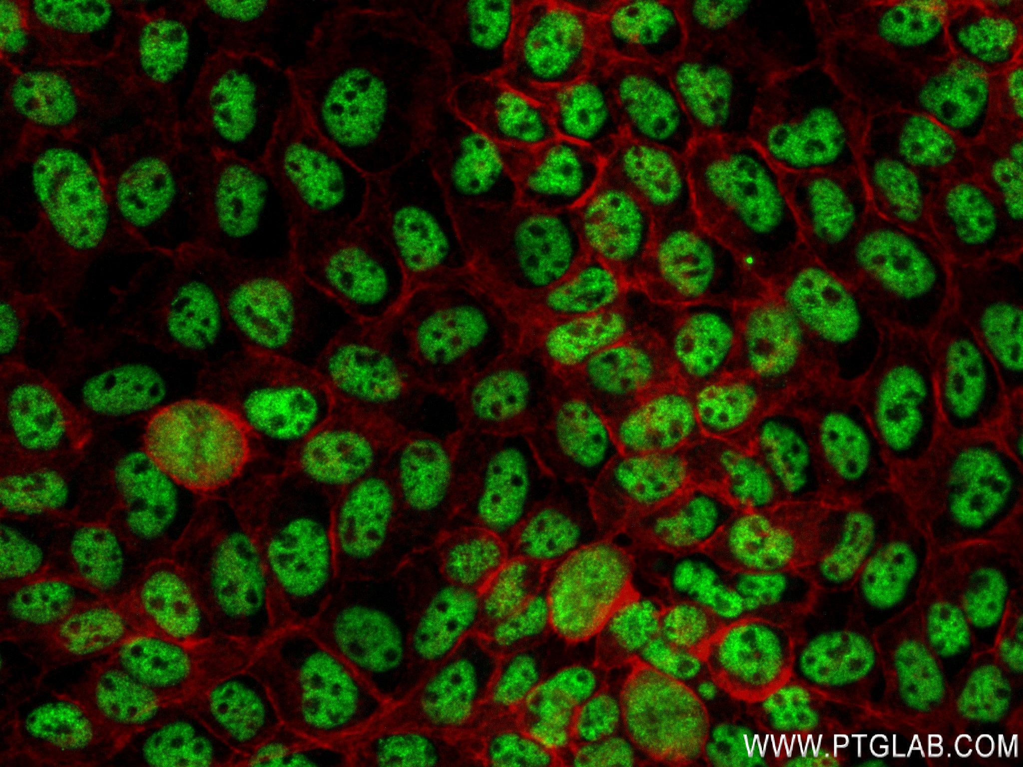 Immunofluorescence (IF) / fluorescent staining of A431 cells using RBM10 Recombinant antibody (84104-2-RR)