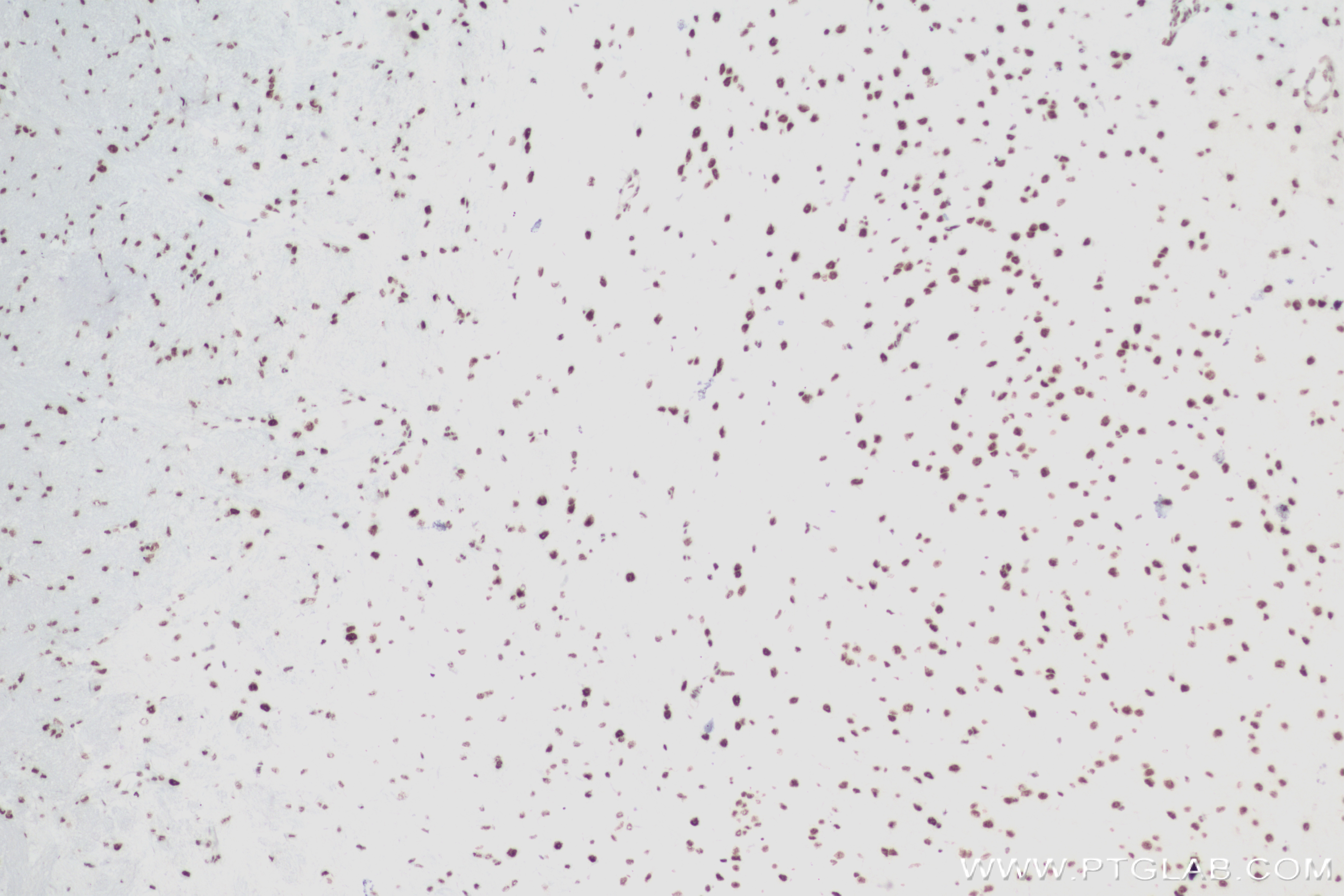 Immunohistochemistry (IHC) staining of mouse brain tissue using RBM10 Recombinant antibody (84104-2-RR)