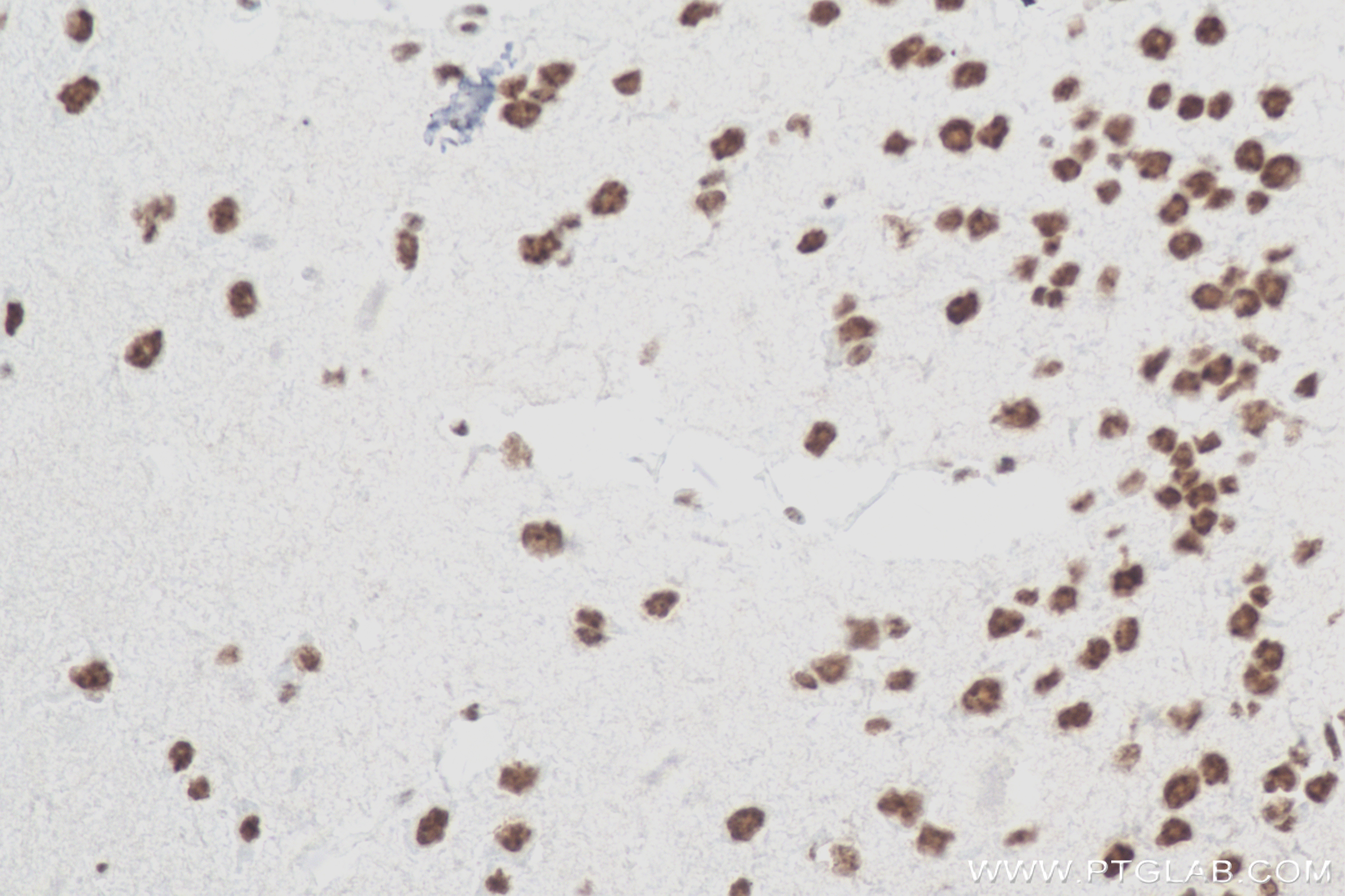 Immunohistochemistry (IHC) staining of mouse brain tissue using RBM10 Recombinant antibody (84104-2-RR)