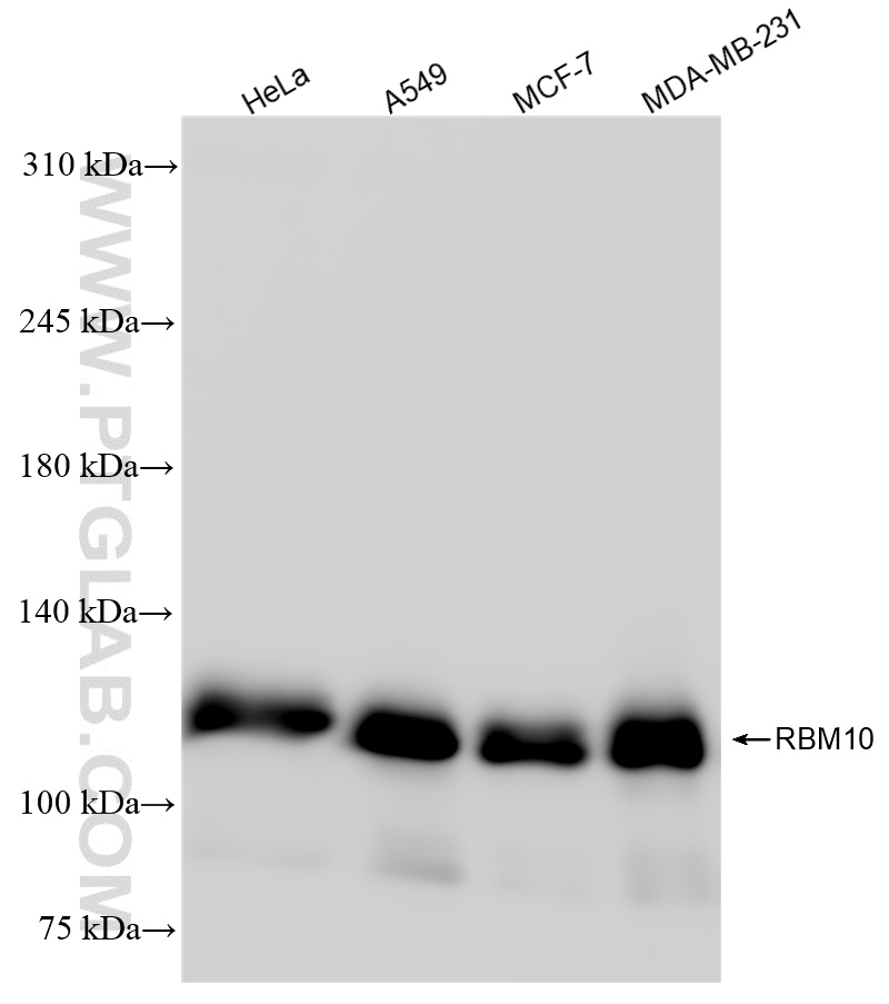 Western Blot (WB) analysis of various lysates using RBM10 Recombinant antibody (84104-2-RR)