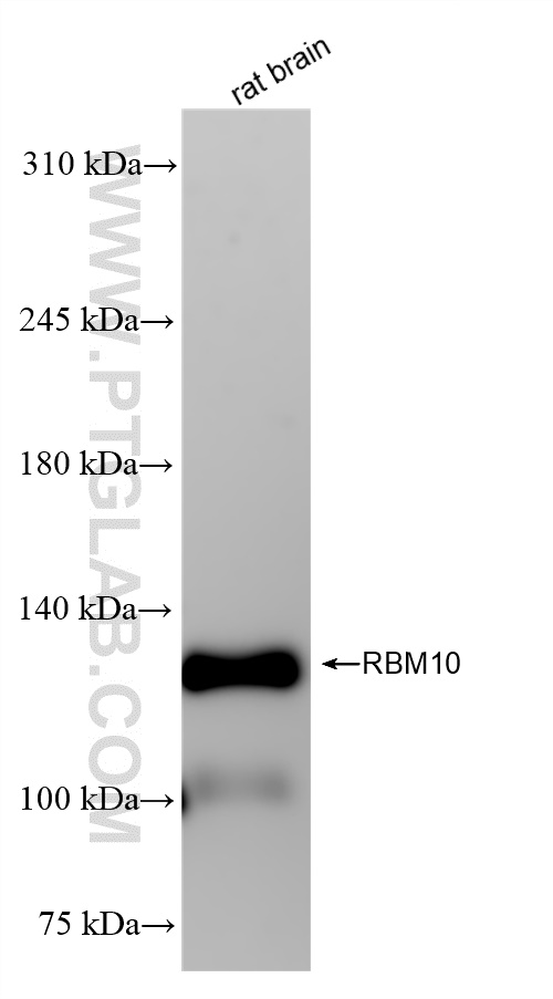 Western Blot (WB) analysis of rat brain tissue using RBM10 Recombinant antibody (84104-2-RR)