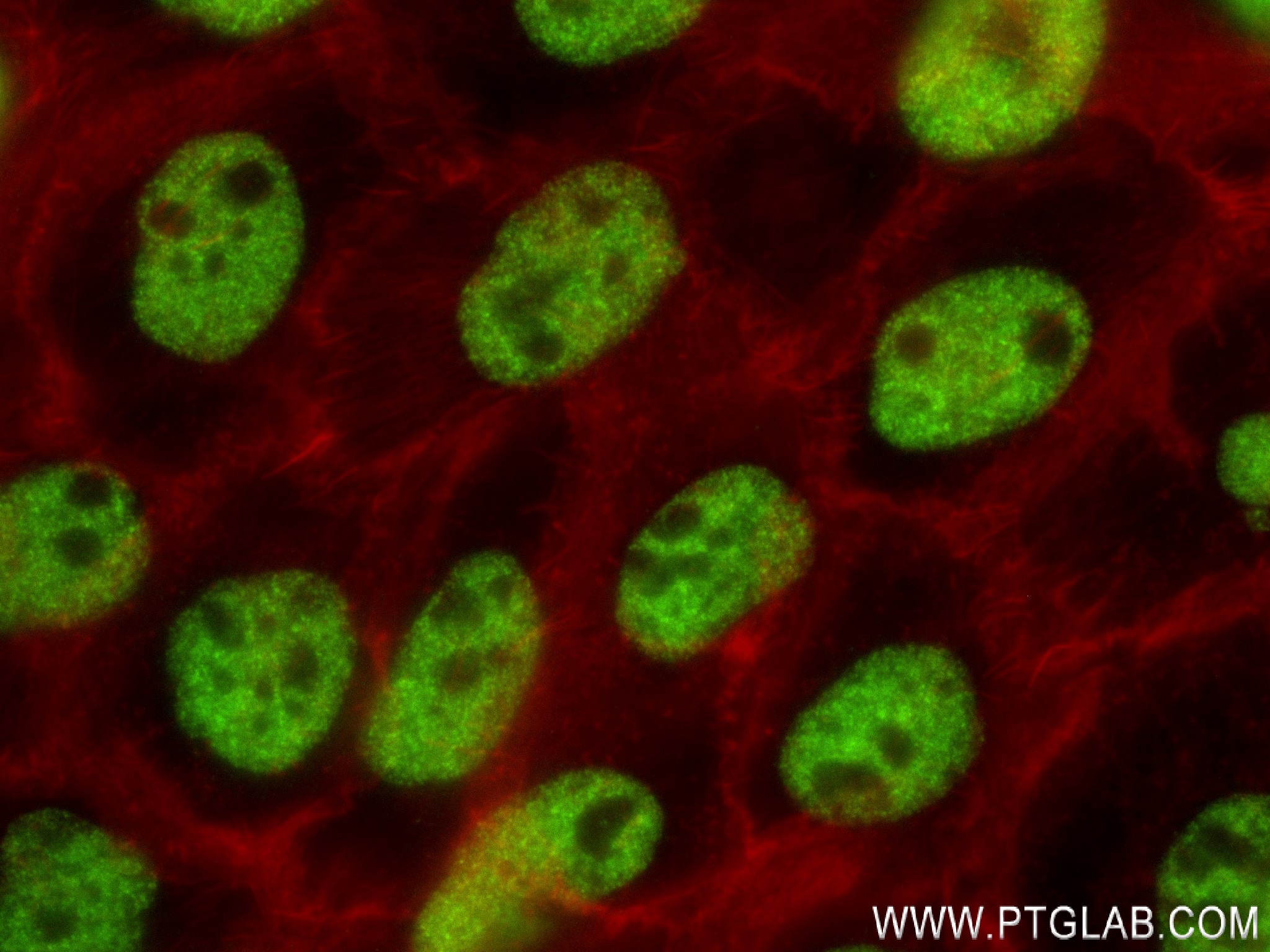 Immunofluorescence (IF) / fluorescent staining of A431 cells using RBM10 Recombinant antibody (84104-4-RR)