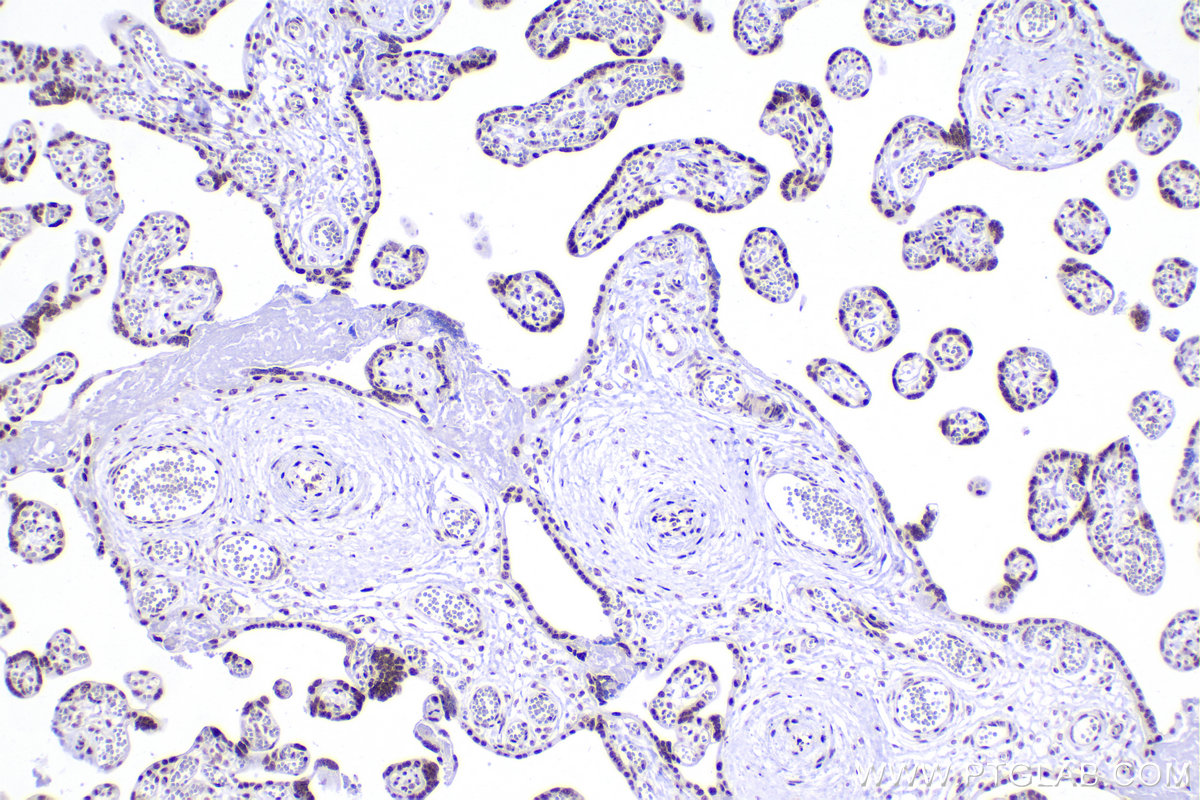 Immunohistochemistry (IHC) staining of human placenta tissue using RBM10 Recombinant antibody (84104-4-RR)