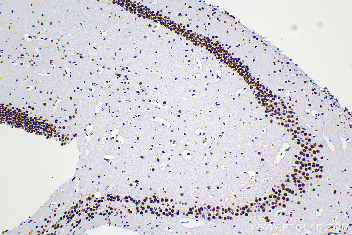 Immunohistochemistry (IHC) staining of mouse brain tissue using RBM10 Recombinant antibody (84104-4-RR)