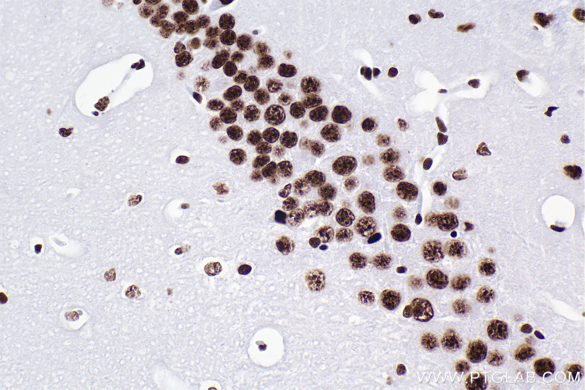 Immunohistochemistry (IHC) staining of mouse brain tissue using RBM10 Recombinant antibody (84104-4-RR)