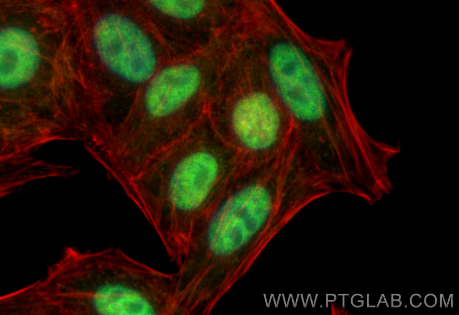 Immunofluorescence (IF) / fluorescent staining of HepG2 cells using RBM15 Polyclonal antibody (10587-1-AP)