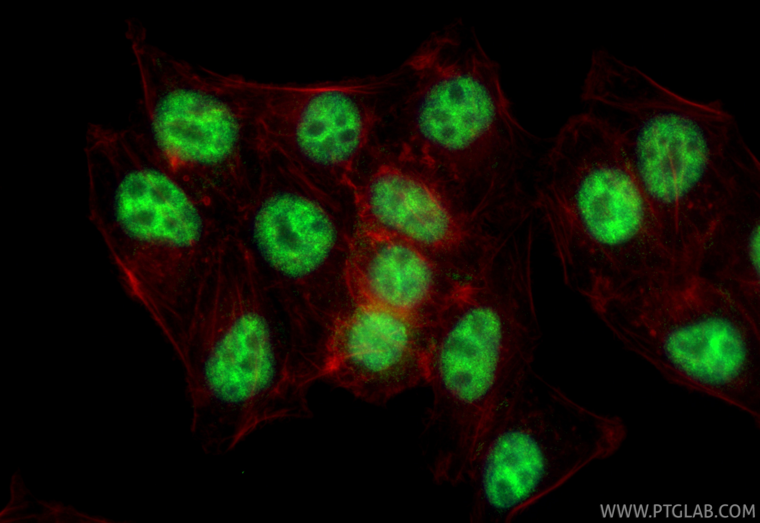 Immunofluorescence (IF) / fluorescent staining of HepG2 cells using RBM15 Polyclonal antibody (10587-1-AP)