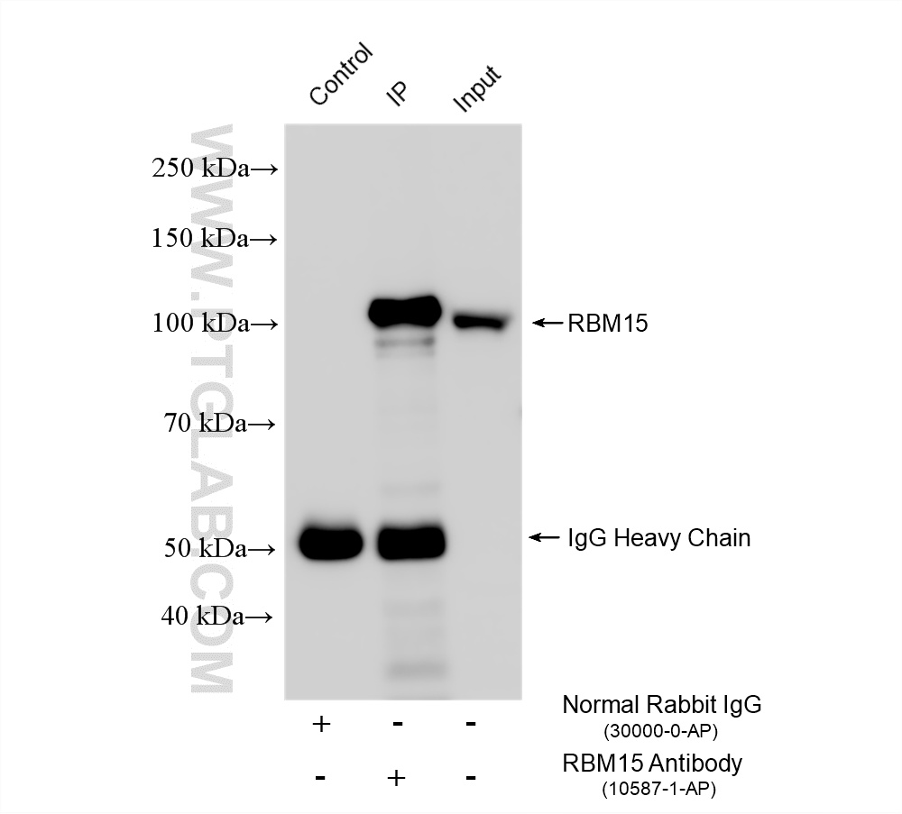Immunoprecipitation (IP) experiment of HEK-293 cells using RBM15 Polyclonal antibody (10587-1-AP)