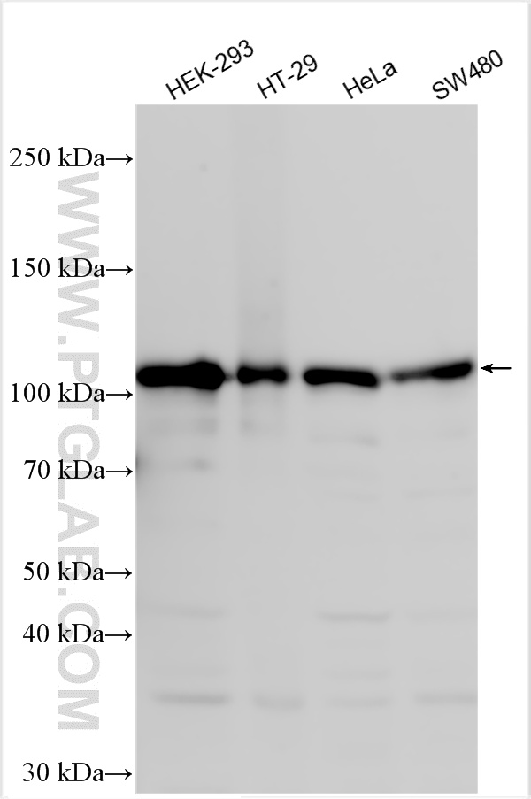 Western Blot (WB) analysis of various lysates using RBM15 Polyclonal antibody (10587-1-AP)