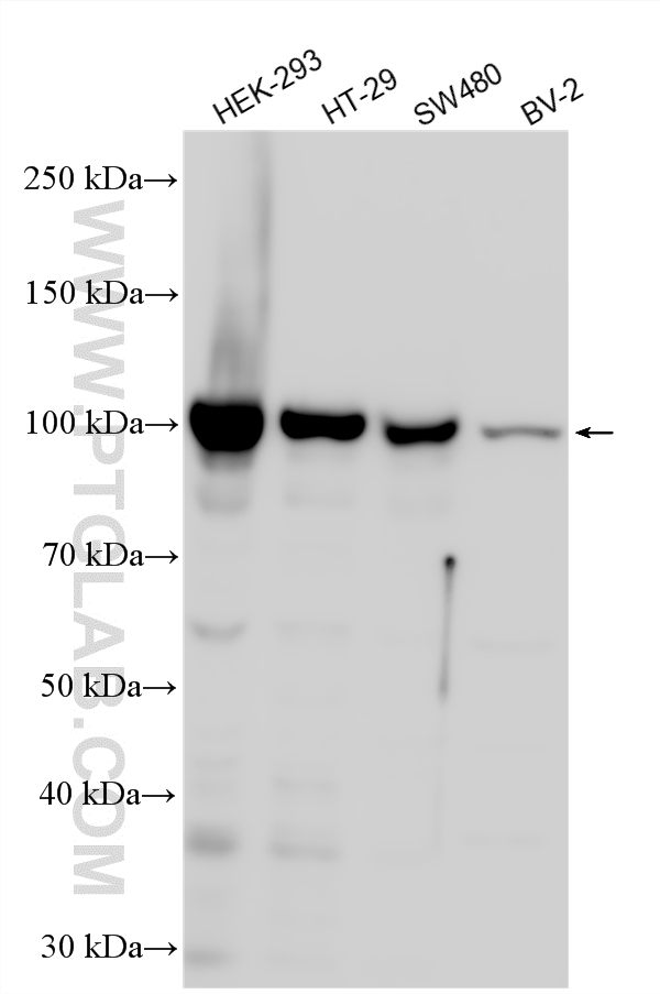 Western Blot (WB) analysis of various lysates using RBM15 Polyclonal antibody (10587-1-AP)