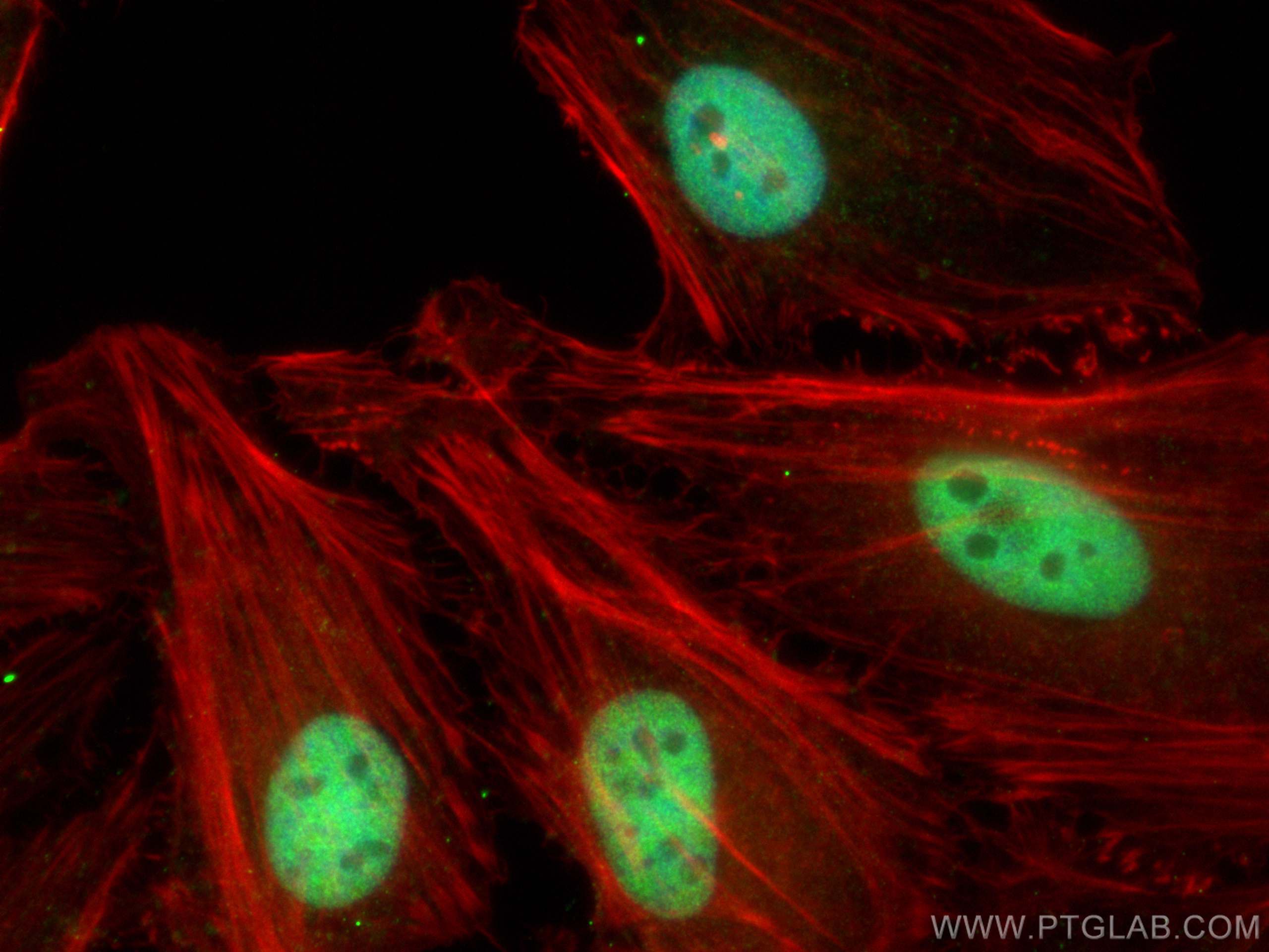 Immunofluorescence (IF) / fluorescent staining of HeLa cells using RBM16 Polyclonal antibody (18893-1-AP)