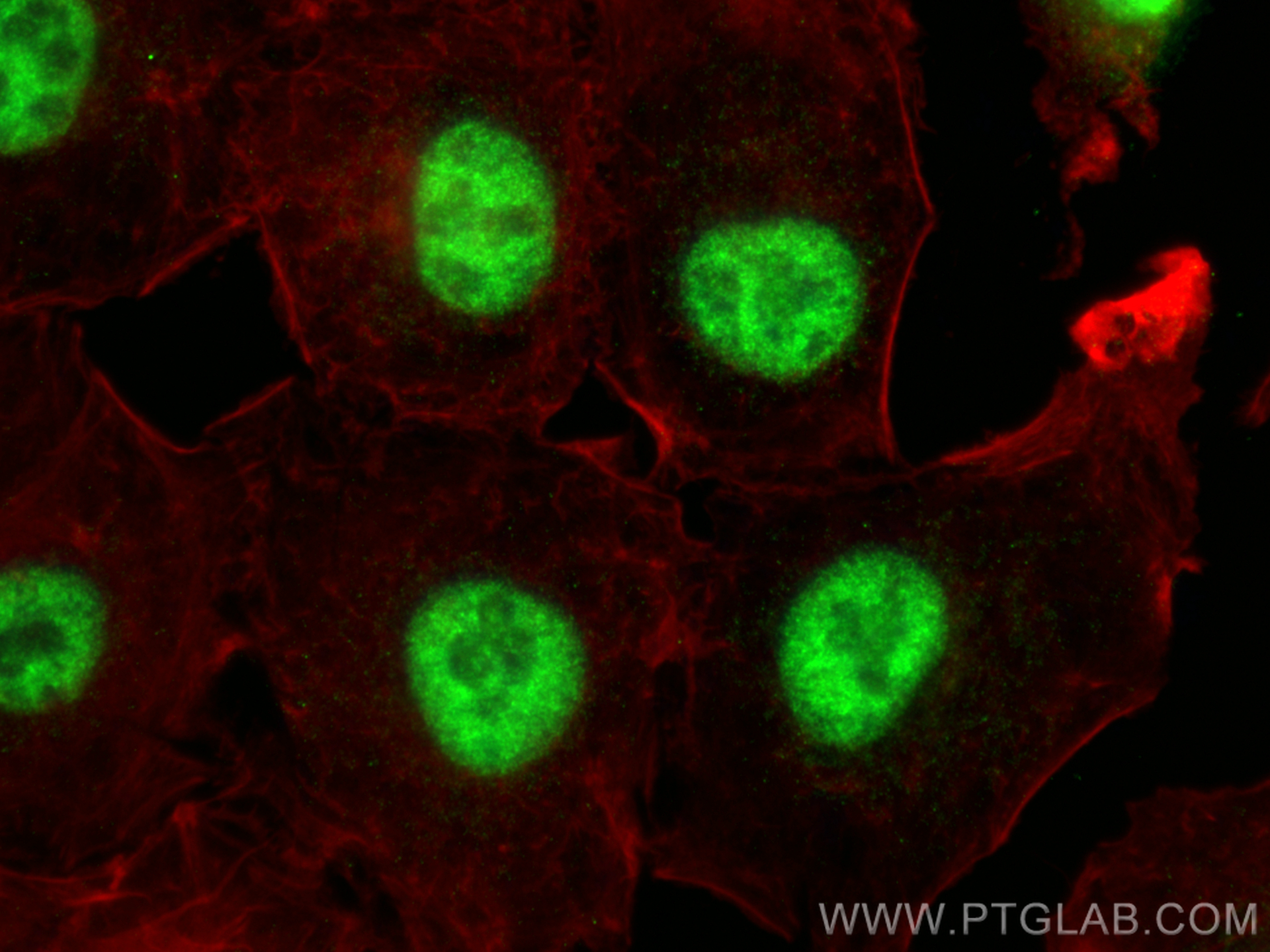 Immunofluorescence (IF) / fluorescent staining of A549 cells using RBM17 Polyclonal antibody (13918-1-AP)