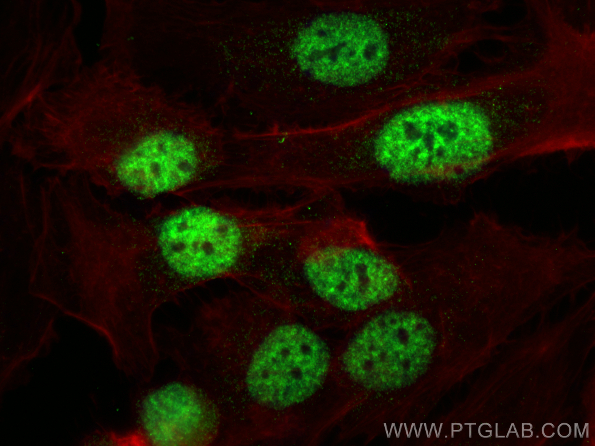 Immunofluorescence (IF) / fluorescent staining of SKOV-3 cells using RBM17 Polyclonal antibody (13918-1-AP)