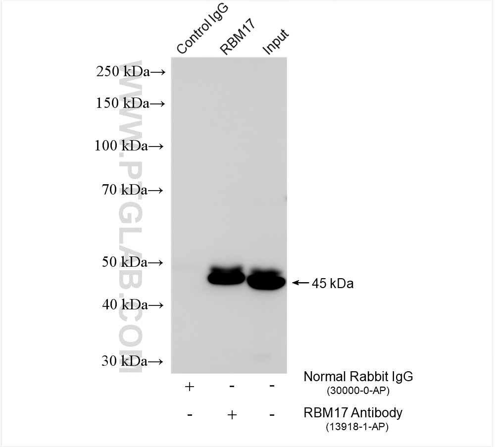 Immunoprecipitation (IP) experiment of MCF-7 cells using RBM17 Polyclonal antibody (13918-1-AP)