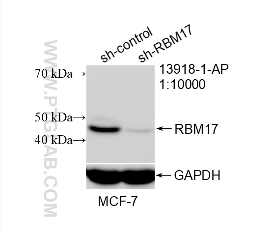 Western Blot (WB) analysis of MCF-7 cells using RBM17 Polyclonal antibody (13918-1-AP)