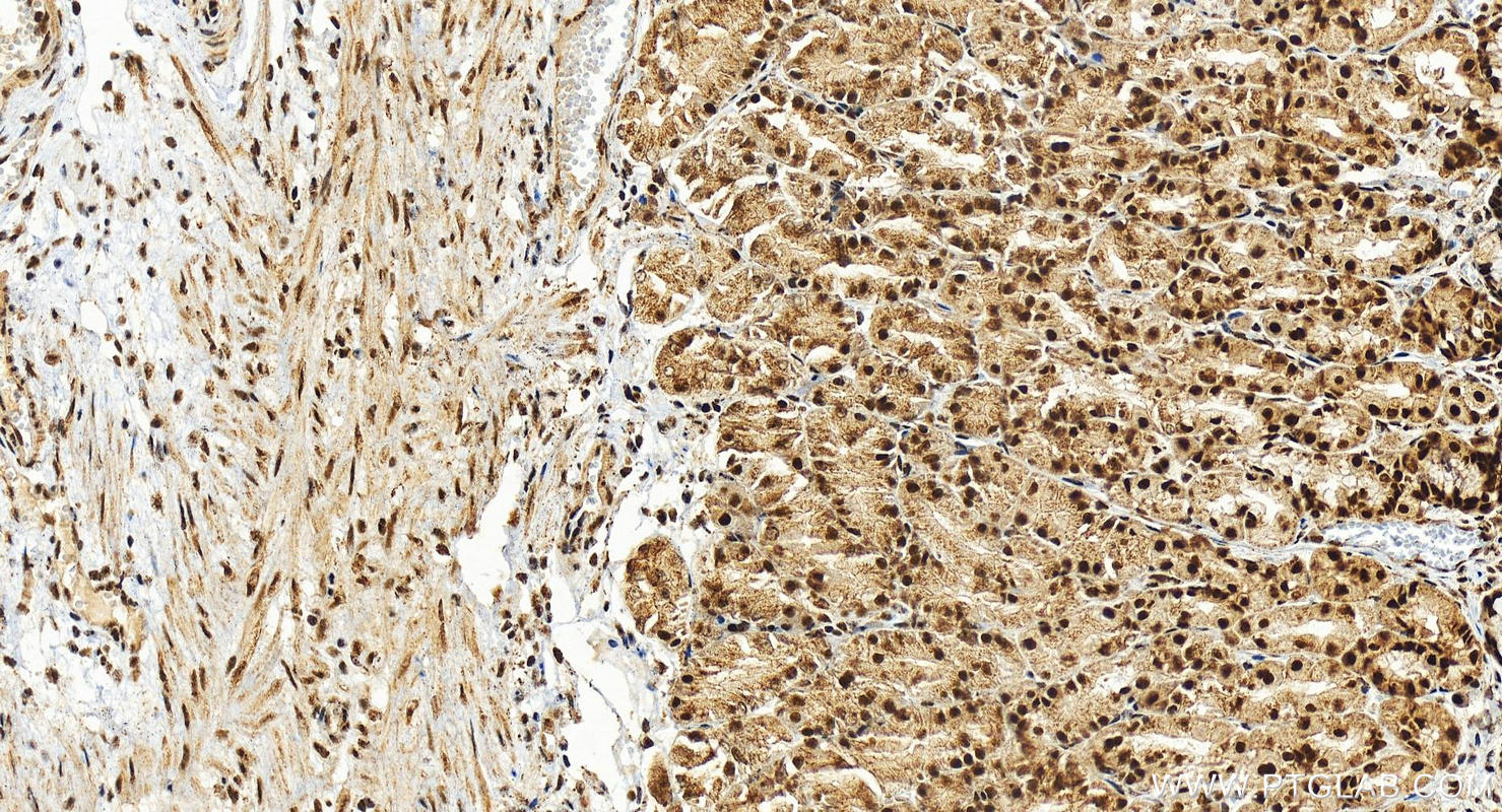 Immunohistochemistry (IHC) staining of human stomach tissue using RBM17 Polyclonal antibody (15374-1-AP)