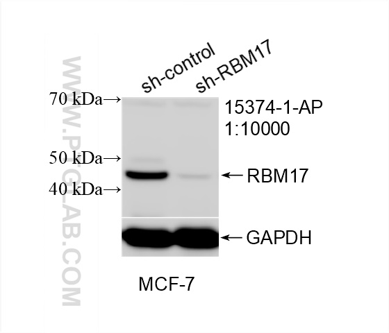 Western Blot (WB) analysis of MCF-7 cells using RBM17 Polyclonal antibody (15374-1-AP)