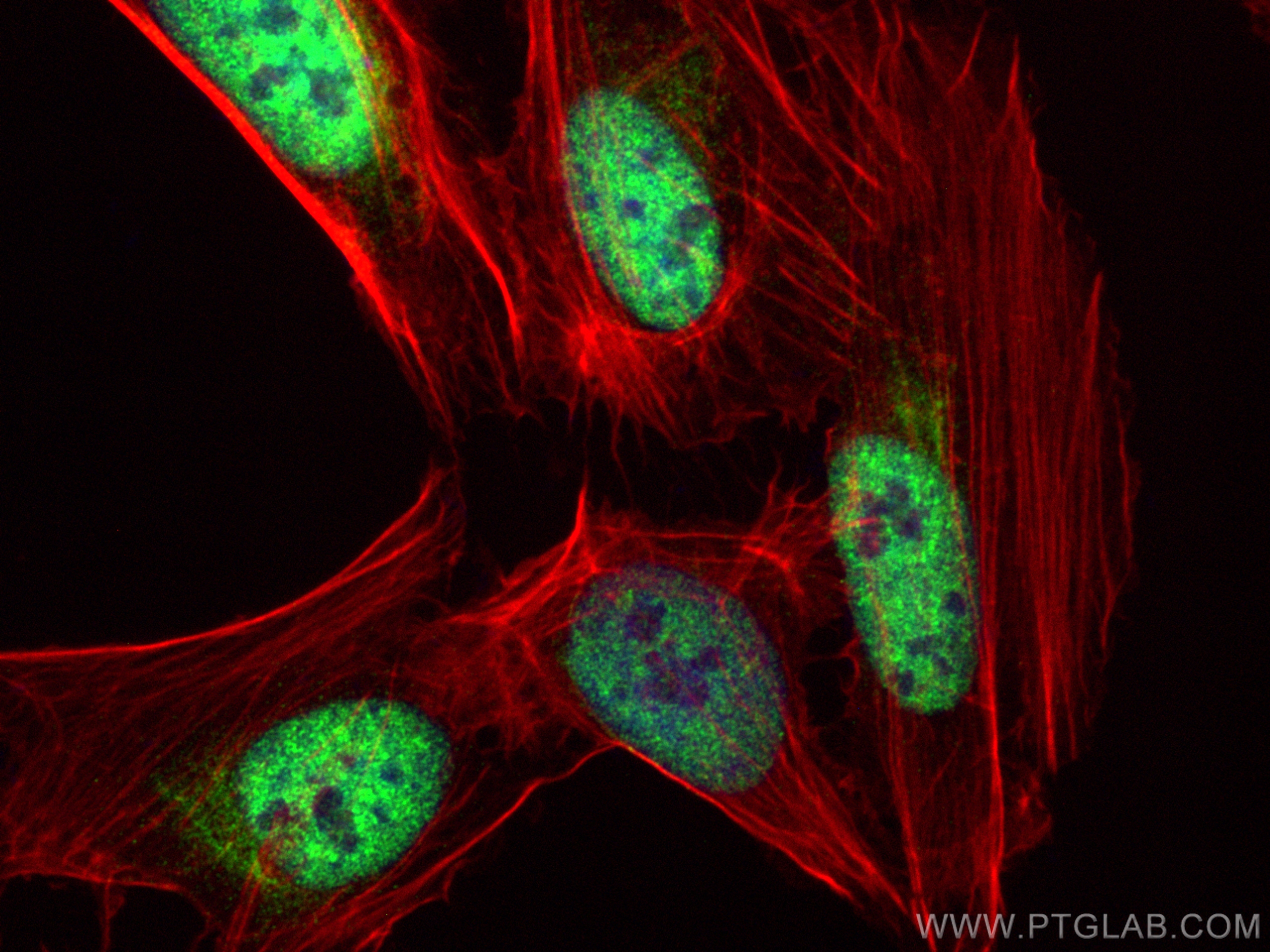 Immunofluorescence (IF) / fluorescent staining of U2OS cells using RBM22 Polyclonal antibody (22103-1-AP)