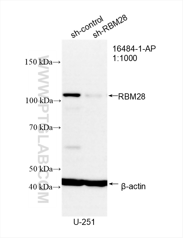 Western Blot (WB) analysis of U-251 cells using RBM28 Polyclonal antibody (16484-1-AP)