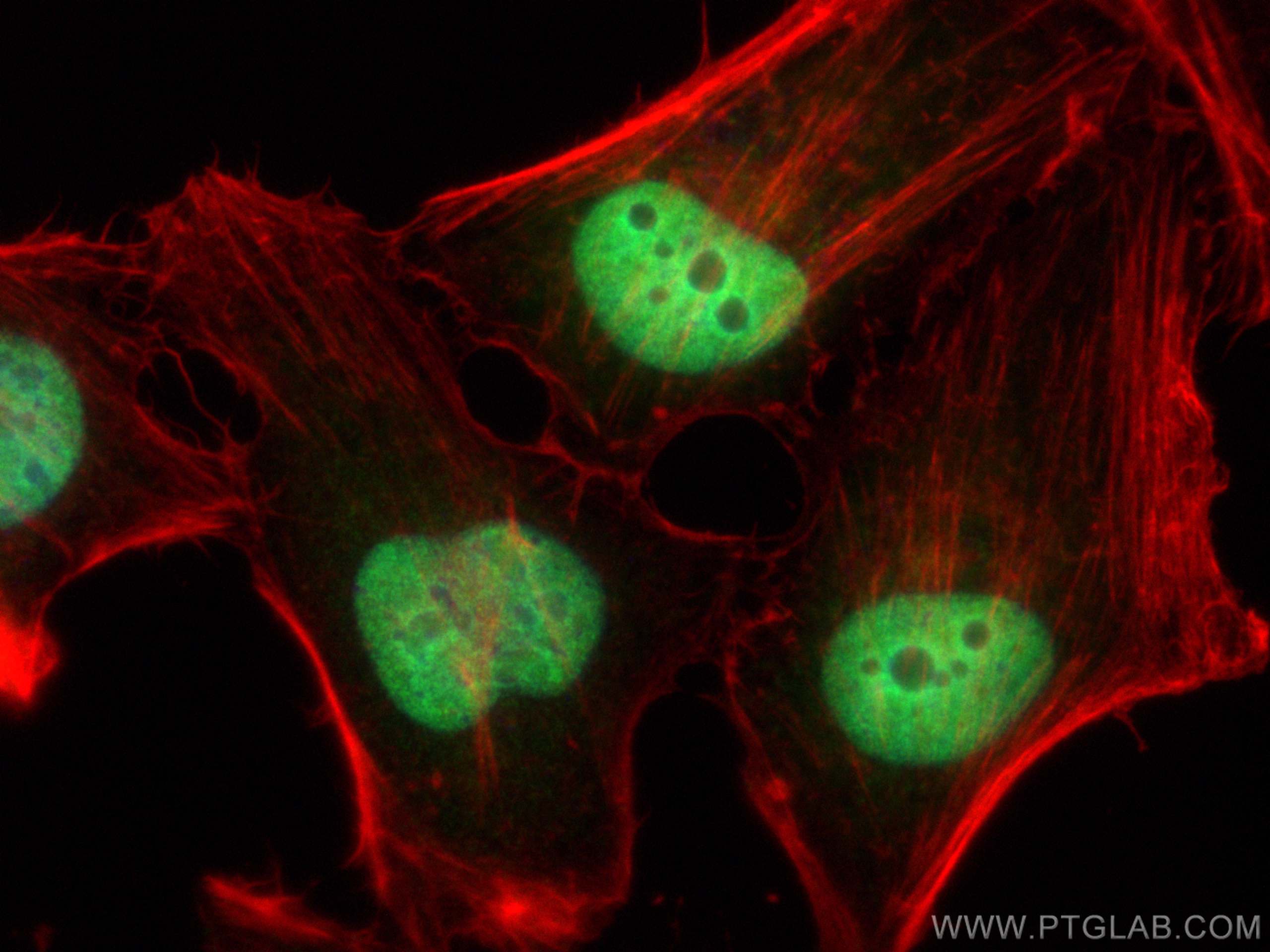 Immunofluorescence (IF) / fluorescent staining of HeLa cells using RBM3 Polyclonal antibody (14363-1-AP)