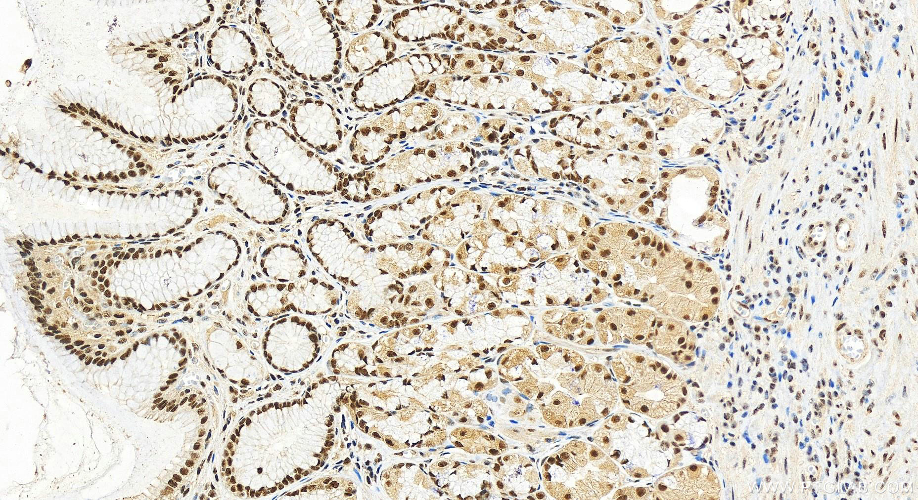 Immunohistochemistry (IHC) staining of human stomach tissue using RBM5 Polyclonal antibody (19930-1-AP)