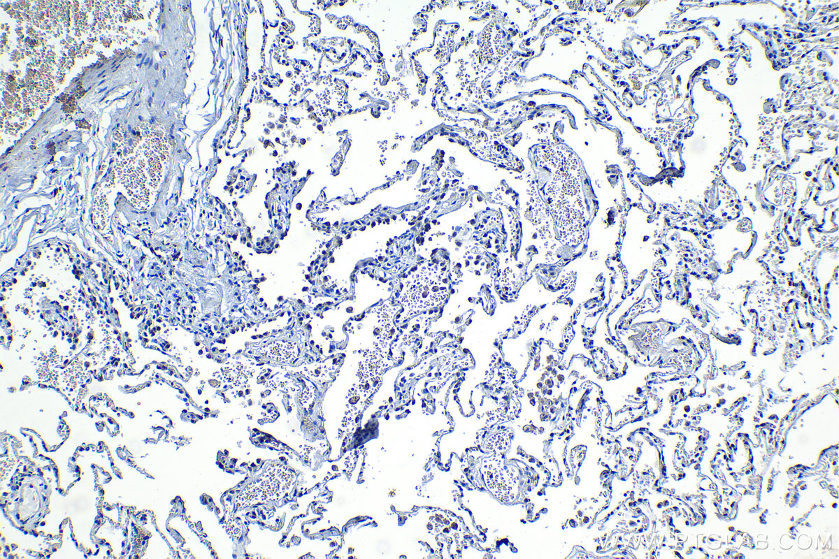 Immunohistochemistry (IHC) staining of human lung tissue using RBM5 Polyclonal antibody (19930-1-AP)