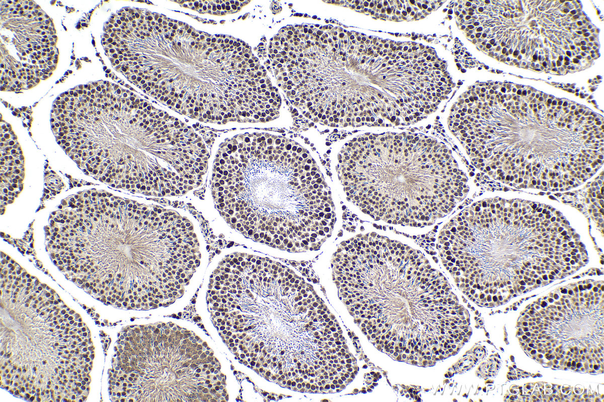 Immunohistochemistry (IHC) staining of rat testis tissue using RBM5 Polyclonal antibody (19930-1-AP)