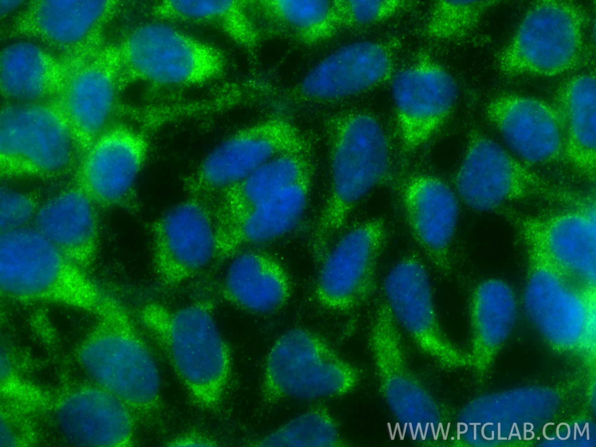 Immunofluorescence (IF) / fluorescent staining of HEK-293 cells using RBP1 Polyclonal antibody (22683-1-AP)