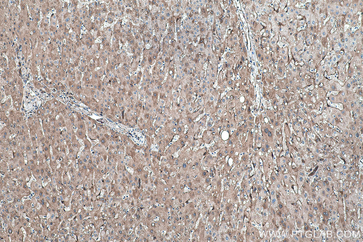 Immunohistochemistry (IHC) staining of human liver tissue using RBP1 Polyclonal antibody (22683-1-AP)