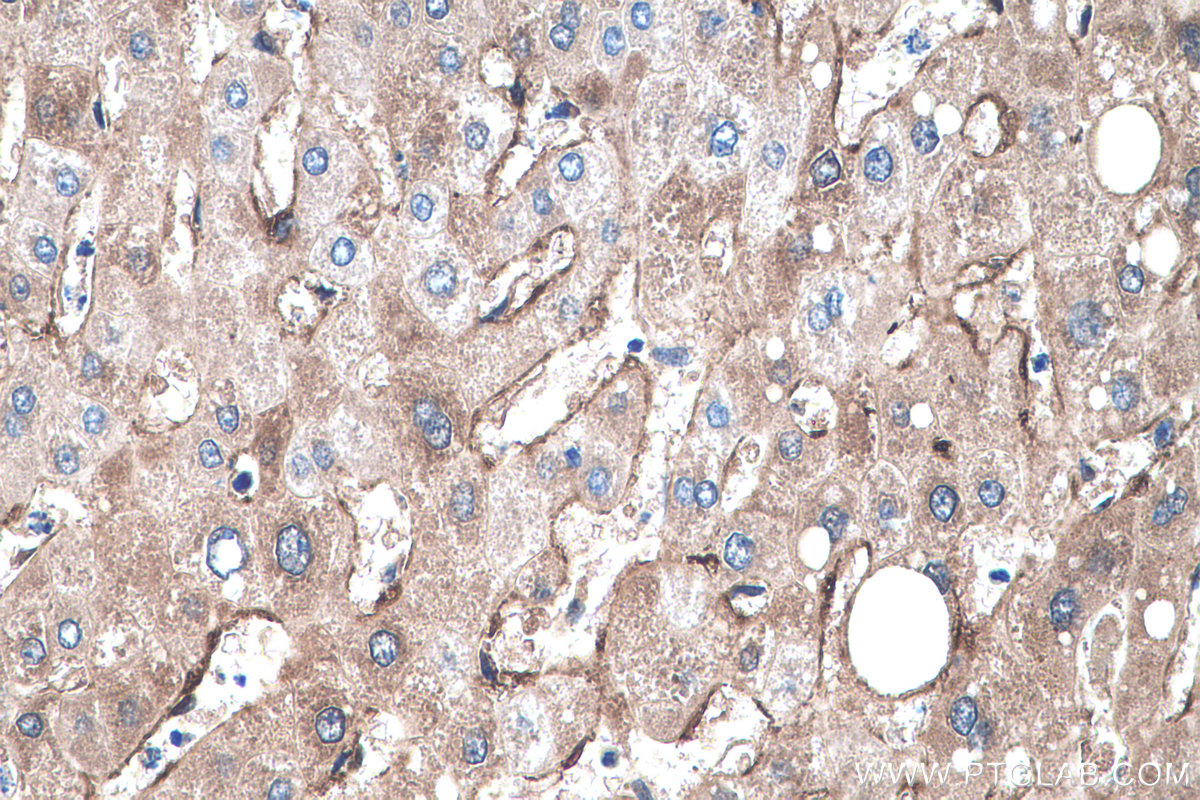 Immunohistochemistry (IHC) staining of human liver tissue using RBP1 Polyclonal antibody (22683-1-AP)