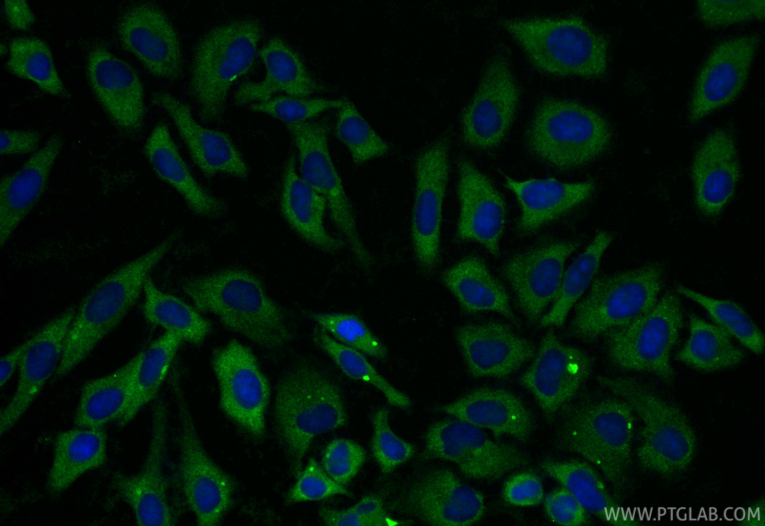 Immunofluorescence (IF) / fluorescent staining of HepG2 cells using RBP4 Polyclonal antibody (11774-1-AP)
