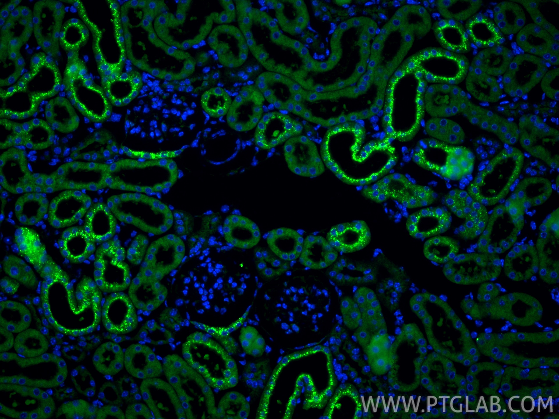 Immunofluorescence (IF) / fluorescent staining of mouse kidney tissue using RBP4 Polyclonal antibody (11774-1-AP)