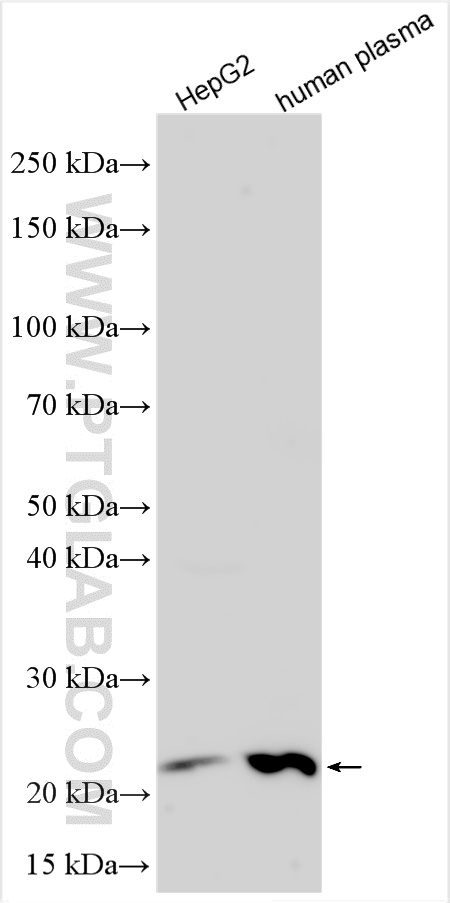 Western Blot (WB) analysis of various lysates using RBP4 Polyclonal antibody (29550-1-AP)