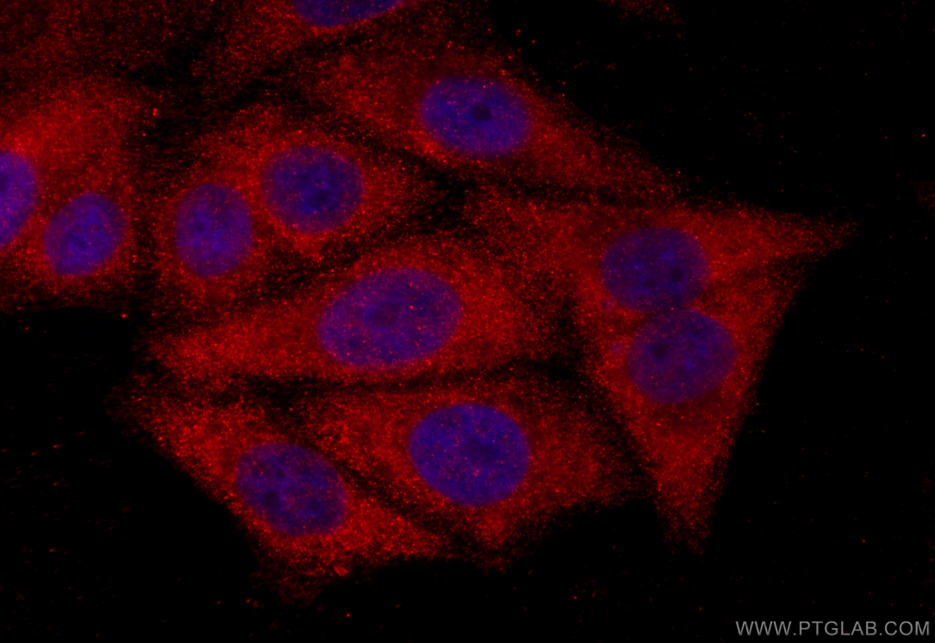 Immunofluorescence (IF) / fluorescent staining of HepG2 cells using RBP5 Polyclonal antibody (11843-1-AP)