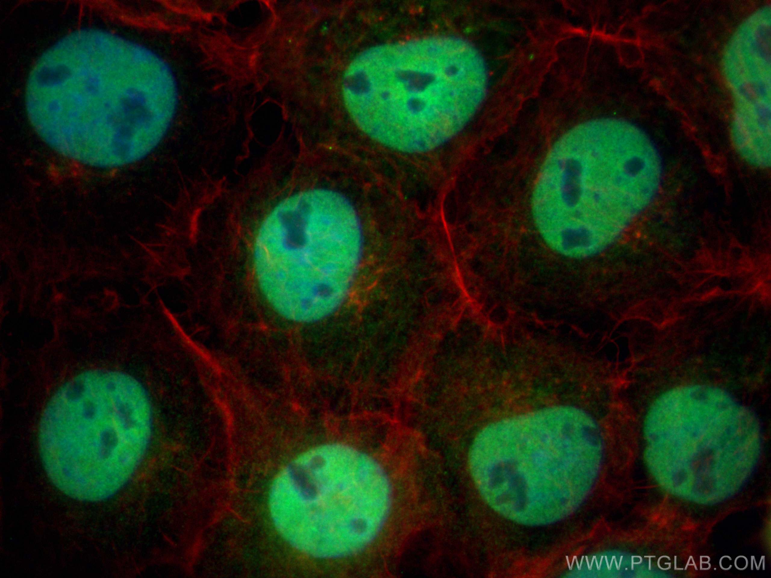 Immunofluorescence (IF) / fluorescent staining of A431 cells using RBX1 Monoclonal antibody (66716-1-Ig)