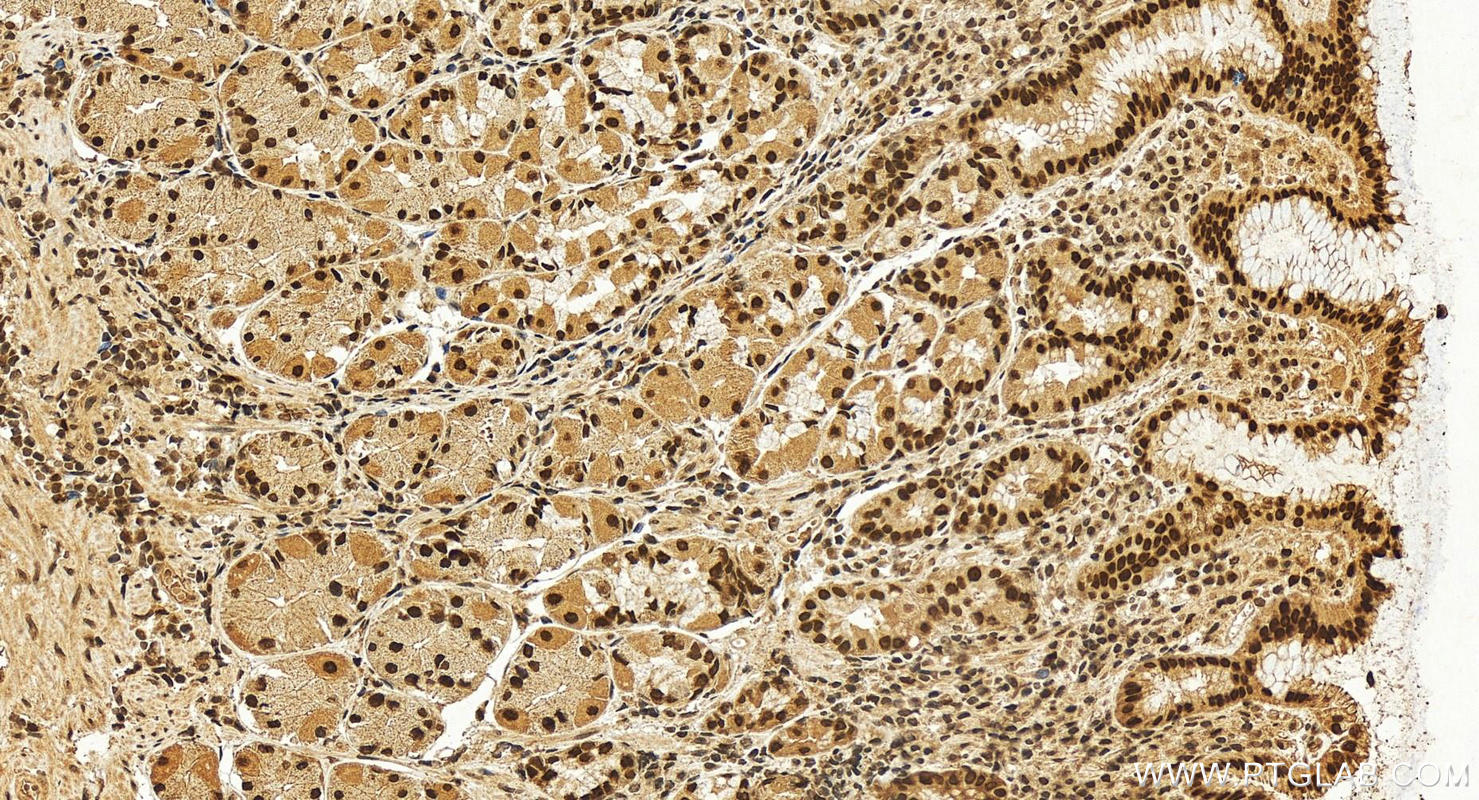 Immunohistochemistry (IHC) staining of human stomach tissue using RCC1 Polyclonal antibody (22142-1-AP)