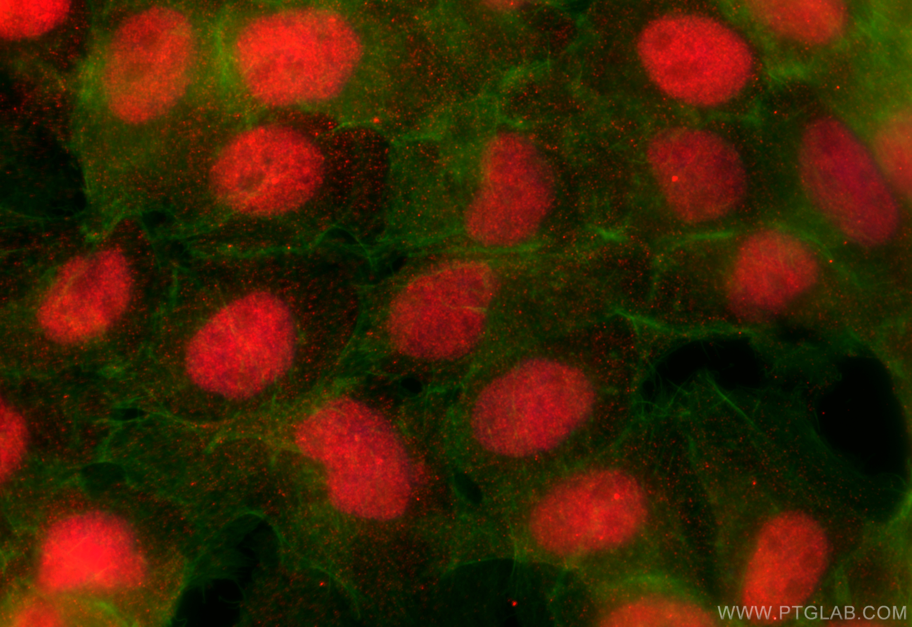 Immunofluorescence (IF) / fluorescent staining of A431 cells using RCC1 Polyclonal antibody (22142-1-AP)