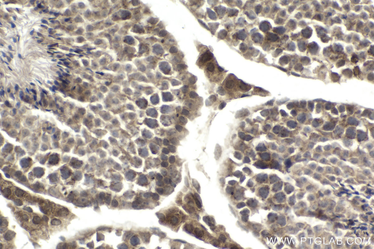 Immunohistochemistry (IHC) staining of mouse testis tissue using RCC2 Polyclonal antibody (16755-1-AP)