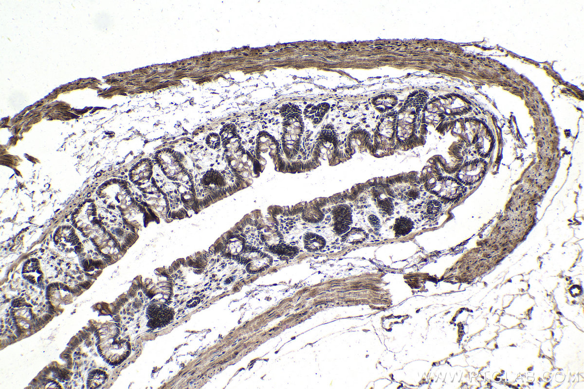 Immunohistochemistry (IHC) staining of rat colon tissue using RCC2 Polyclonal antibody (16755-1-AP)